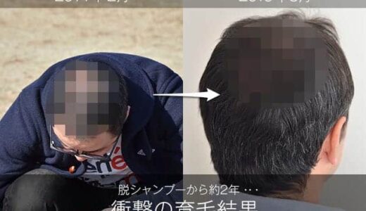 脱シャンプーで髪は本当に増えたのか!? 衝撃の結果と洗髪方法と育毛グッズを紹介