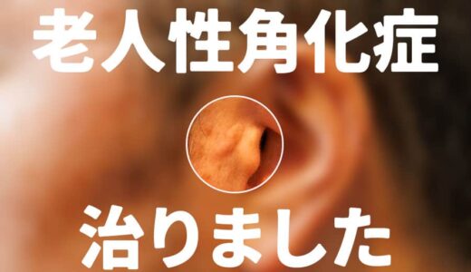 顔に水ぶくれみたいなできものが出来たので皮膚科行ったら…